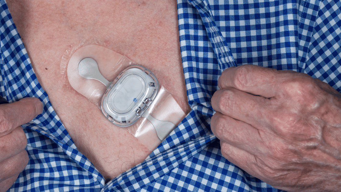 Remote Check Pacemaker Remote Patient Monitoring RPM